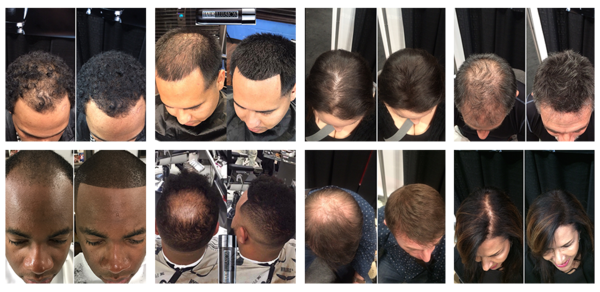 100% Real Hair Fibers HI18G-DK BROWN 100% Real Hair Fibers HI18G-DK BROWN