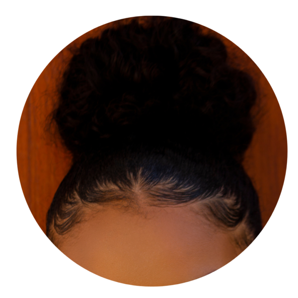 Baby hairs