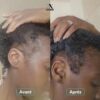 gelules cure pousse de cheveux 1 mois 655193 200x